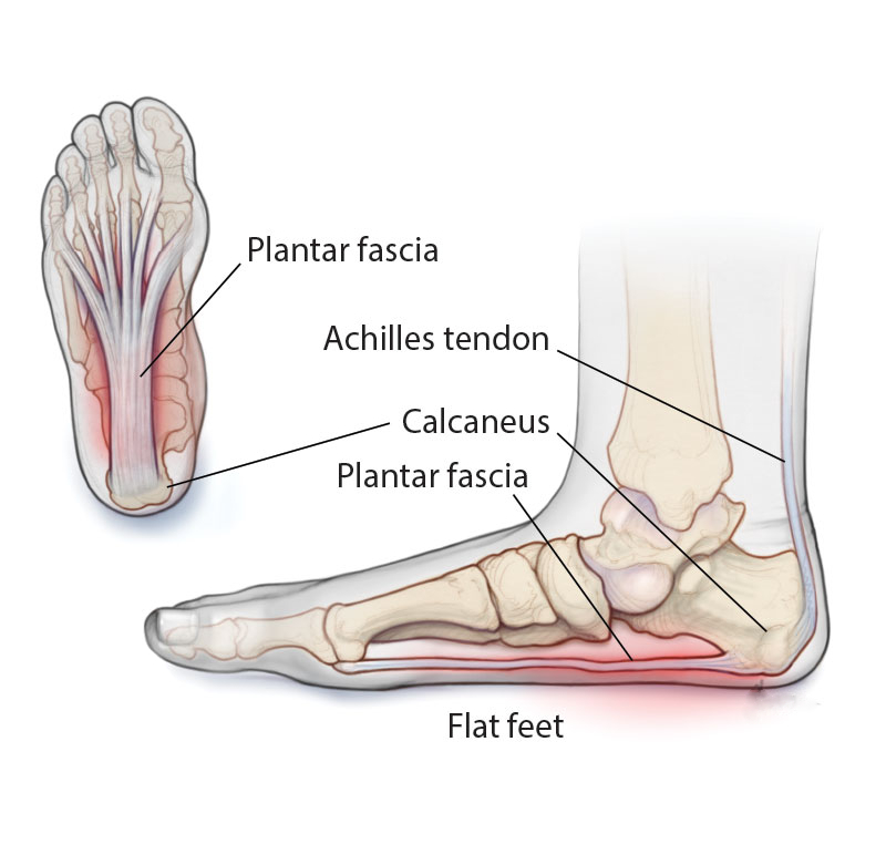 Plantar Fascia Anatomy Diagram Plantar Fascia Anatomy Diagram