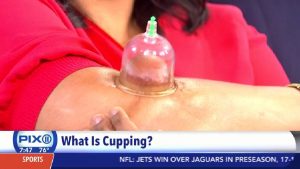 Pix11: What is Cupping